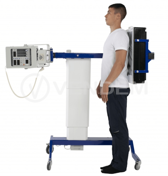 Универсальный рентгеновский комплект с функцией скрининга DM100P+ DR (1.8 кВт)