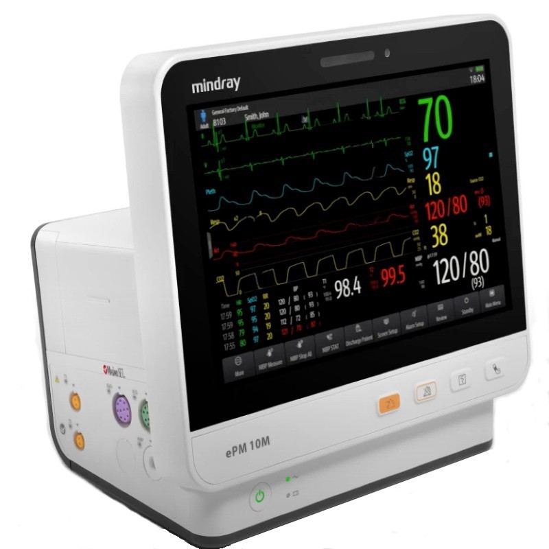 Монитор пациента прикроватный монитор imec 12