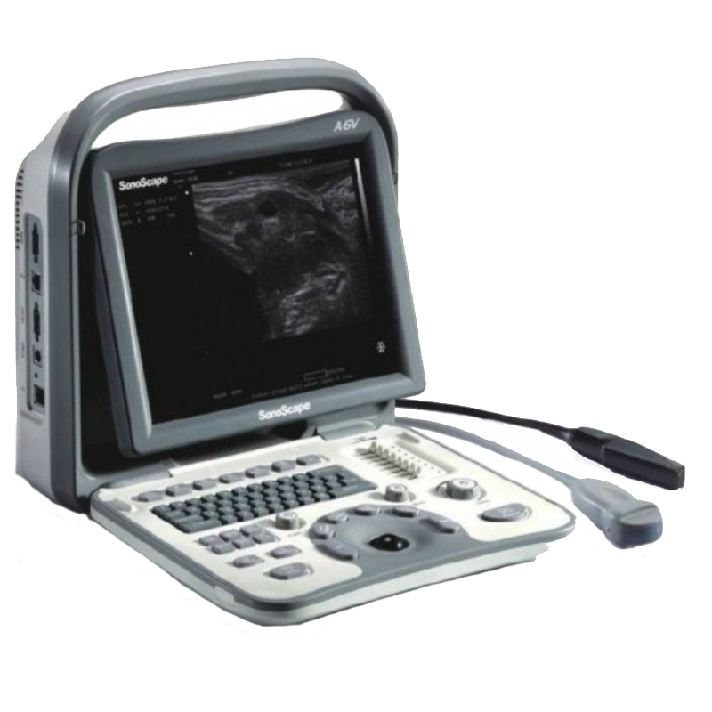 Аппарат УЗИ SONOSCAPE. ACUVISTA rs880b. УЗИ аппарат Diagnostic Ultrasound. Соноскейп УЗИ аппараты.