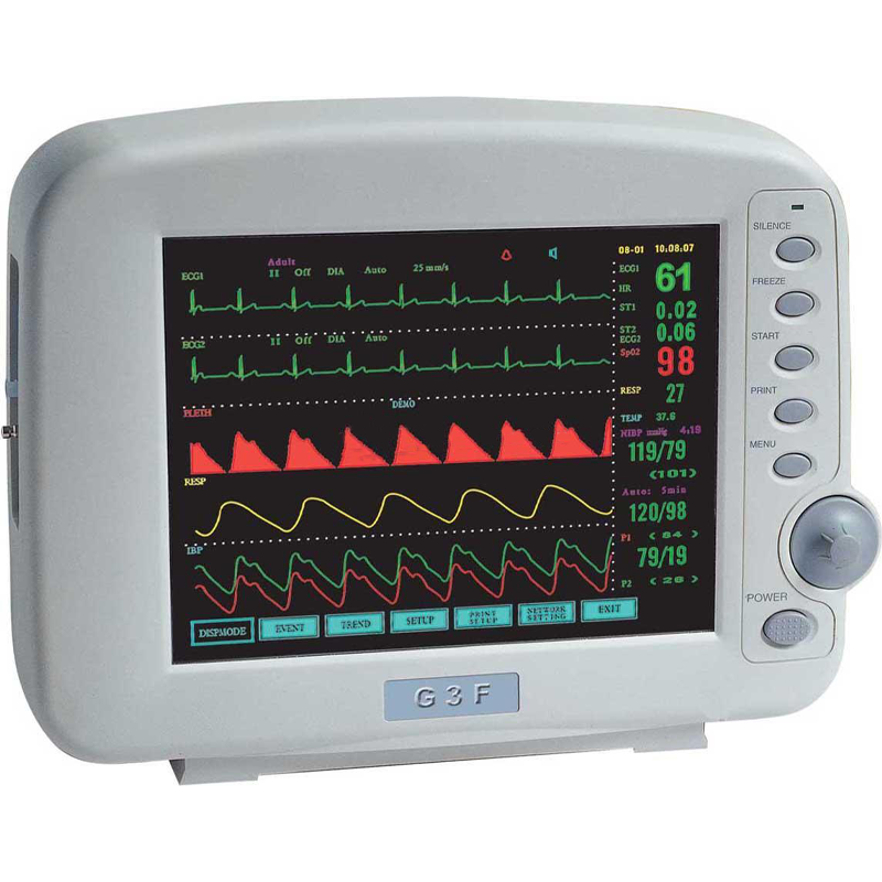 Контроль импульсов. Монитор пациента General Meditech g3g. Монитор прикроватный пациента Митар -01-р-д. Монитор прикроватный General Meditech g3d. Монитор Митар-01 р-д.