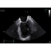 Аппарат УЗИ (сканер) GE Healthcare Vivid E90