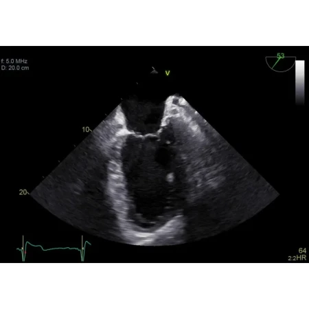 Аппарат УЗИ (сканер) GE Healthcare Vivid E90