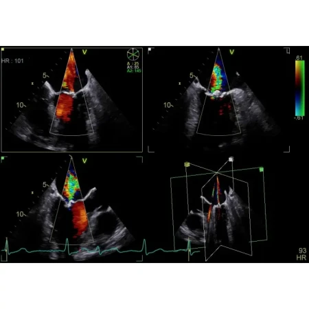 Аппарат УЗИ (сканер) GE Healthcare Vivid E90