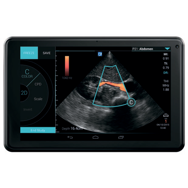 Аппарат УЗИ Fujifilm Sonosite iViz