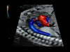 Аппарат УЗИ (сканер) GE Healthcare Voluson E10 RSA
