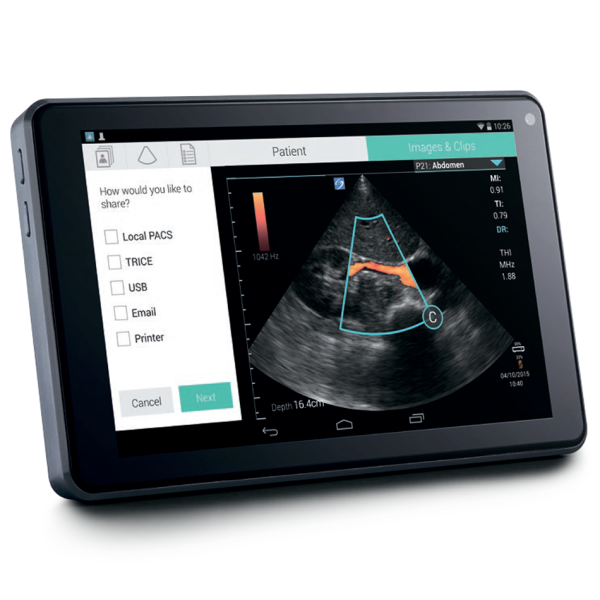 Аппарат УЗИ Fujifilm Sonosite iViz
