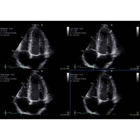 Аппарат УЗИ (сканер) GE Healthcare Vivid E90