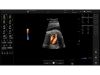 Аппарат УЗИ (сканер) GE Healthcare Versana Essential