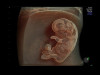 Аппарат УЗИ (сканер) GE Healthcare Voluson E10 RSA