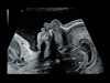 Аппарат УЗИ (сканер) GE Healthcare Voluson E10 RSA