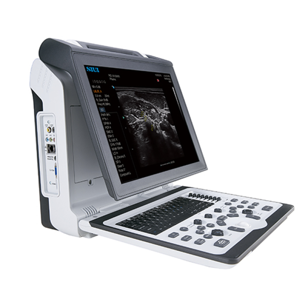 Аппарат УЗИ Siui New Apogee 1100