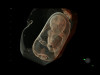 Аппарат УЗИ (сканер) GE Healthcare Voluson E10 RSA