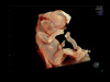 Аппарат УЗИ (сканер) GE Healthcare Voluson E10 RSA
