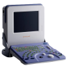 Аппарат УЗИ Hitachi Prosound 2