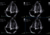 Аппарат УЗИ (сканер) GE Healthcare Vivid S70N