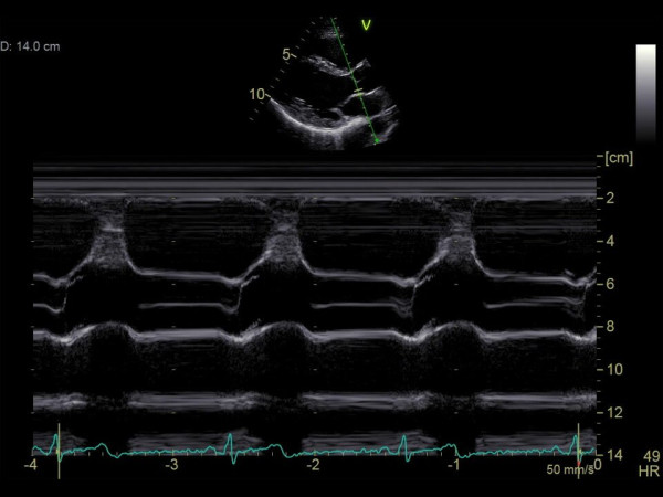 Аппарат УЗИ (сканер) GE Healthcare Vivid S60N