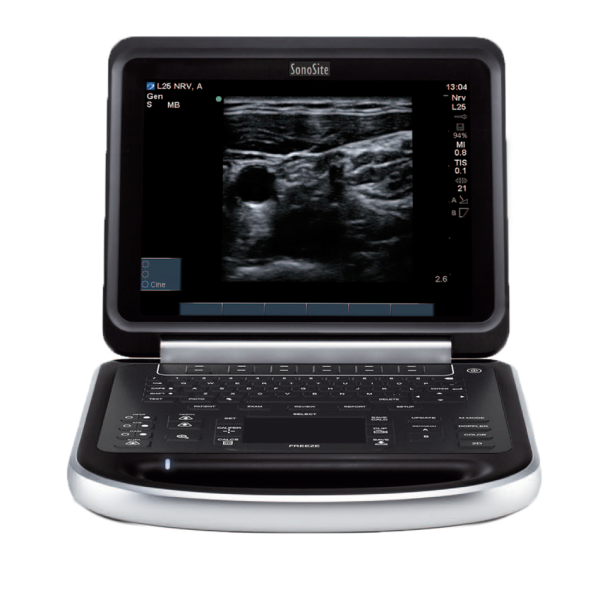 Аппарат УЗИ Fujifilm Sonosite Edge
