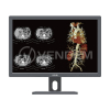 Медицинский монитор Jusha CR240G
