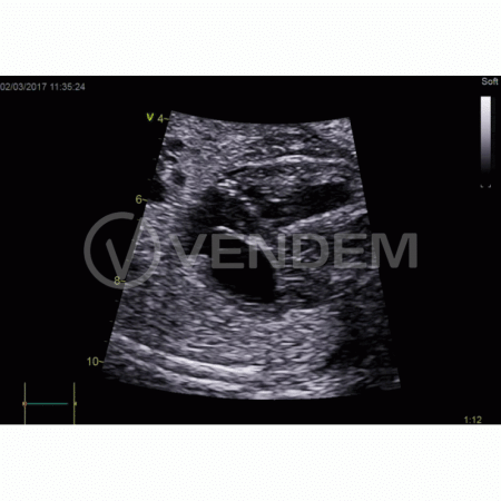 Аппарат УЗИ (сканер) GE Healthcare Vivid E90