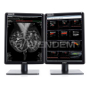 Медицинский монитор Barco Nio Color 5MP MDNC-6121