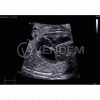 Аппарат УЗИ (сканер) GE Healthcare Vivid E90