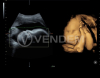 Аппарат УЗИ (сканер) GE Healthcare Voluson S8