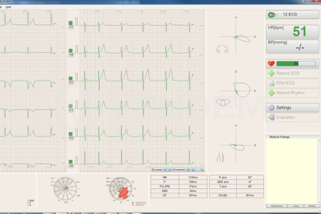 Электрокардиограф (ЭКГ) BTL FLEXI 12 с возможностью подключения к системе BTL CardioPoint ECG C600