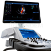 Ультразвуковой аппарат GE Vivid E95