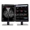 Медицинский монитор Barco Nio Color 5MP MDNC-6121