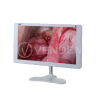 Монитор медицинский Storz Medical