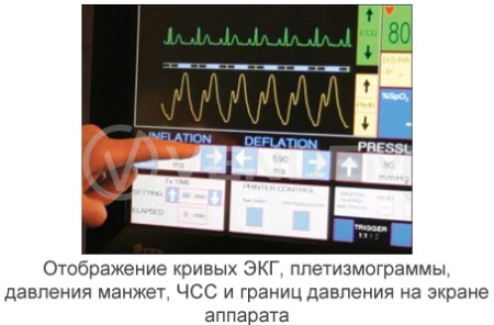 Аппарат усиленной наружной контрпульсации Chongqing PSK-Health P-ECP/TI (КНР)