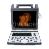 Аппарат УЗИ Siui CTS 7700