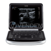 Аппарат УЗИ Fujifilm Sonosite Edge