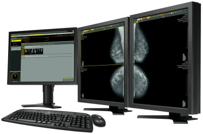 АРМ врача МТЛ Диарм-МТ для просмотра маммографических изображений
