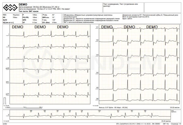 Модуль SDS для BTL CardioPoint