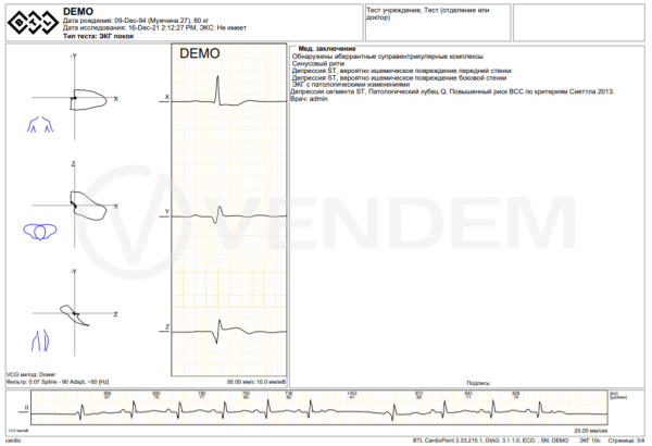 Модуль SDS для BTL CardioPoint